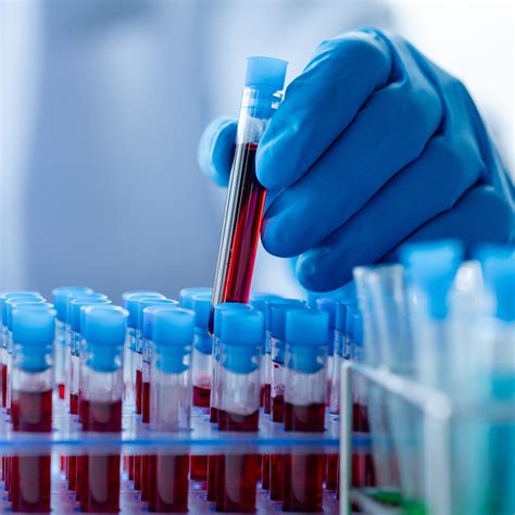 IVF pasiruošimo etapas: tyrimai ir medikamentai