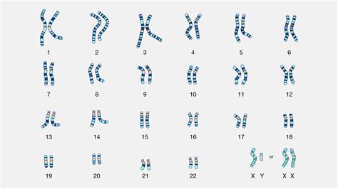 Chromosomų kariotipo analizės pavyzdys