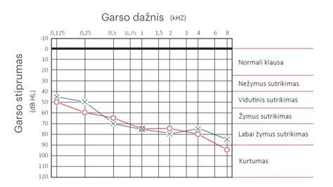 Skaidrių lentelė su klausos sutrikimo laipsniais ir rekomendacijomis