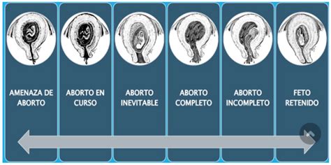 Psichologinės emocinės būklės po aborto diagrama