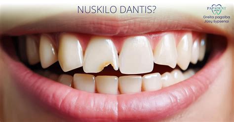 Išmuštas pieninis dantis ir nuolatinio danties užuomazga