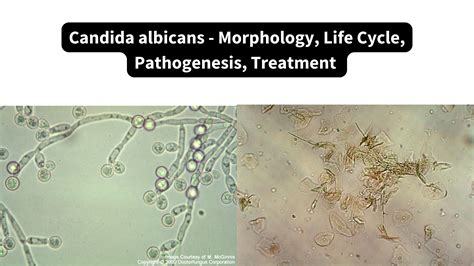 Candida albicans grybelio sandara ir paveikslėlis