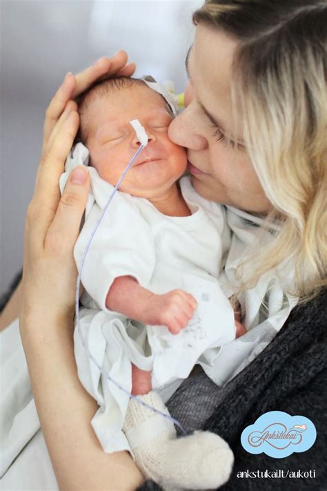 Neišnešioto naujagimio išvaizda