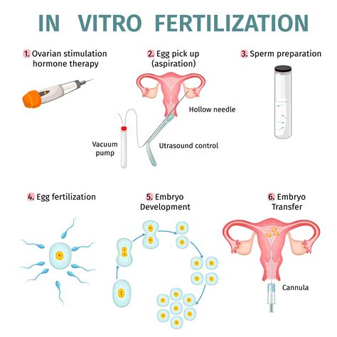 IVF (In Vitro Fertilization) proceso schema