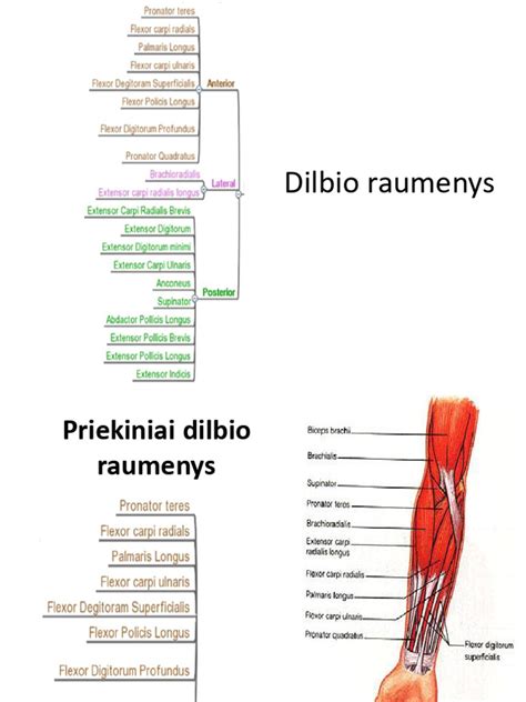Cerebrinio paralyžiaus tipų iliustracija ir paveikti raumenys