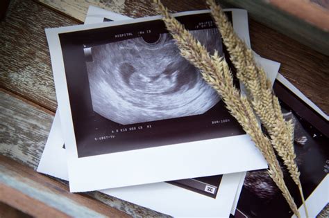 Besilaukianti Sim su ultragarso nuotrauka