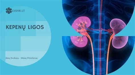 Naujagimio gelta ir kepenų ligos