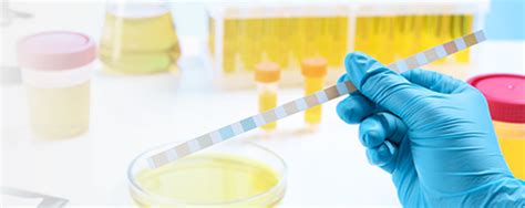 Nevaisingumo tyrimai