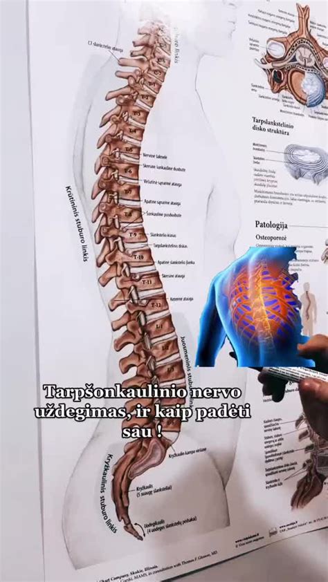 Tarpšonkaulinės neuralgijos priežastys ir paveikta sritis