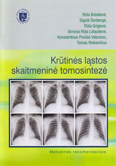 Krūtinės ląstos deformacijos schema po traumos