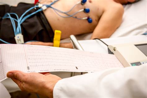 EKG tyrimas