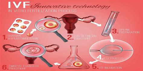 Apvaisinimo in vitro (IVF) procesas