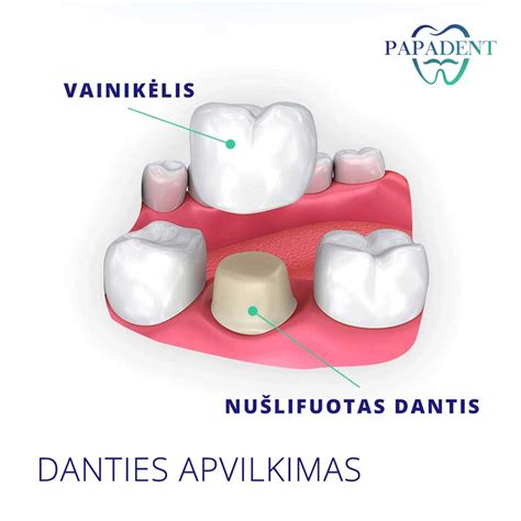 Protinio danties dygimo eiga ir amžius