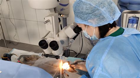 Lazerinės akių operacijos schema