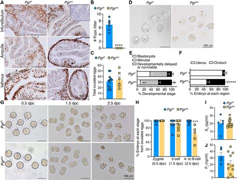 Spermatozoidų kelionė moters reprodukciniame trakte