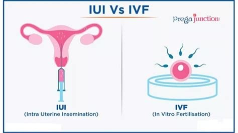 infografikas, lyginantis IUI ir IVF procedūras