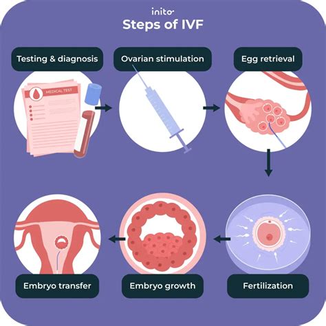 Schema, iliustruojanti IVF procedūros etapus