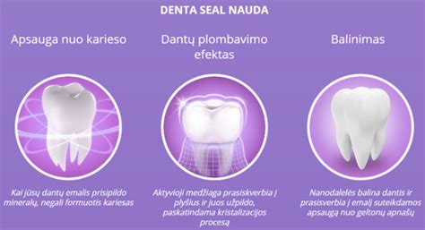 Schematinis vaizdas, kaip veikia sedacija dantų gydymo metu