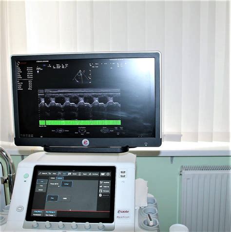 moderni medicinos įranga vaisingumo klinikoje