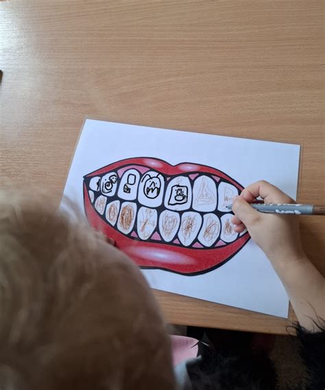 priežastys, kodėl vaikai serga dantų kariesu