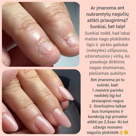 Priešpienio lašelis ant piršto