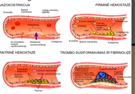 Schema, iliustruojanti pirminės ir antrinės trombocitozės skirtumus.