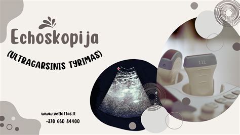 Echoskopijos tyrimas
