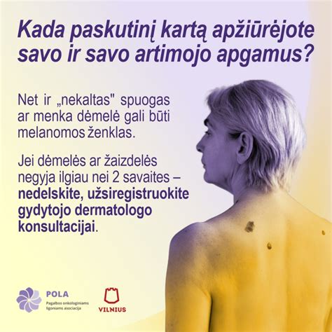 Melanomos didelis padidinimas