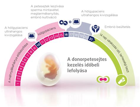 IVF indikacijų infografika