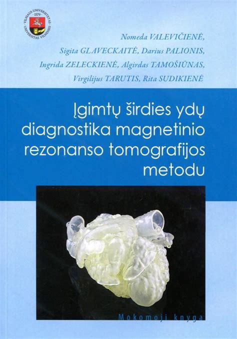 Infografika: įgimtų širdies ydų dažnumas Lietuvoje