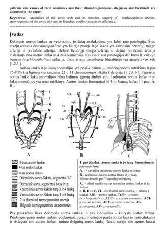 Širdies anatomijos schema su įgimtų ydų vietomis