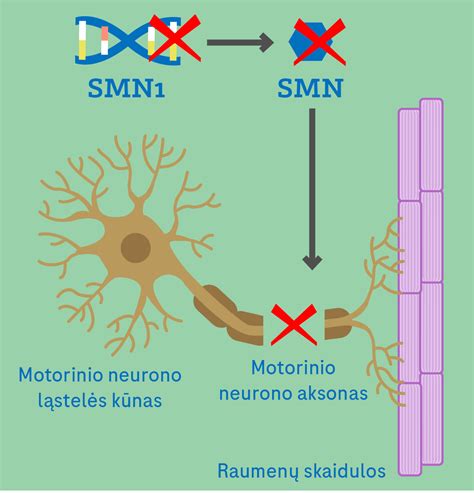 Autizmo atsiradimo genetinės ir aplinkos priežastys
