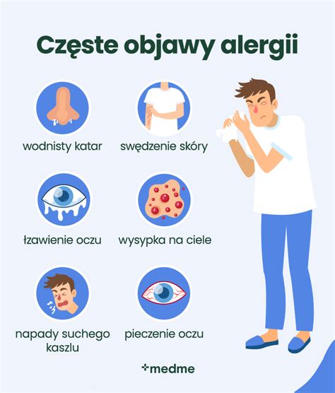 Alergijos simptomai kūdikiams