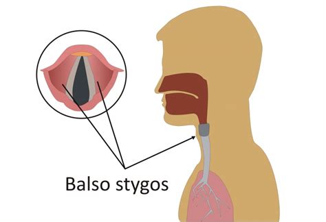 vaiko balso stygos