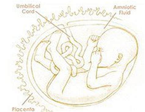 Priešlaikinio gimdymo požymiai