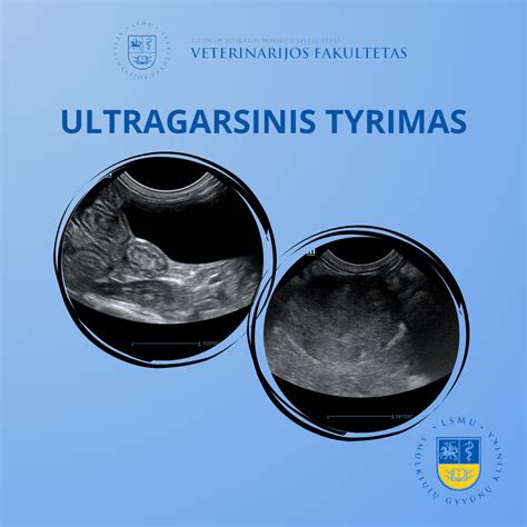 ginekologas, atliekantis ultragarsinį tyrimą