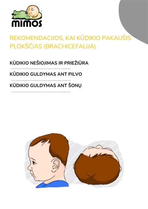 Brachicefalija: suplokštėjęs ir praplatėjęs pakaušis