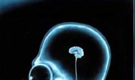 Schematinis vaizdas kaip smegenys juda kaukolėje purtymo metu