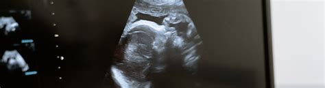 Nėštumo testas ir ultragarso vaizdas