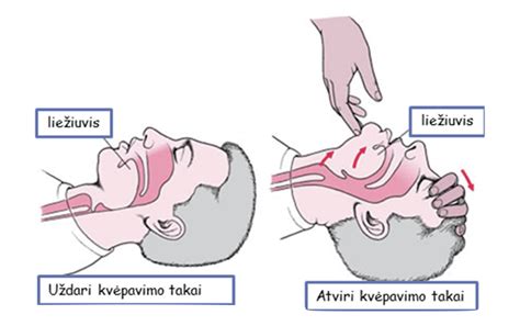 Schema, kaip atverti kvėpavimo takus