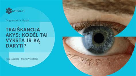 Schema: kada sunerimti dėl akių traiškanų