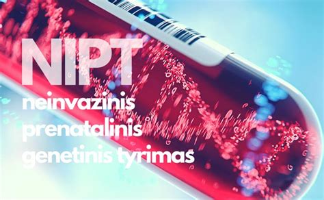 Neinvazinis prenatalinis tyrimas (NIPT)