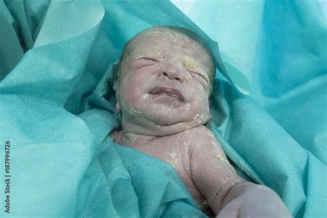 Kūdikio odos apsauginis sluoksnis (vernix caseosa)