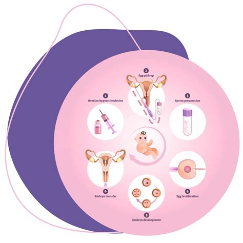 IVF proceso schema nuo stimuliacijos iki nėštumo testo