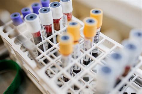 Kraujo tyrimų mėginiai
