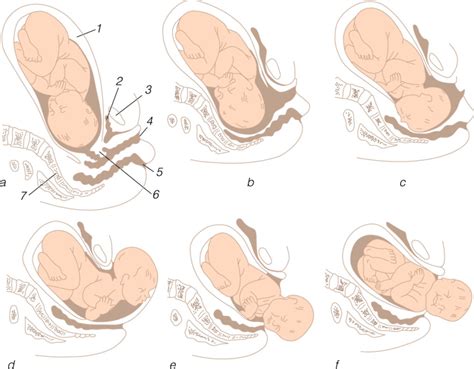 Stangų ir gimdymo biomechanizmas