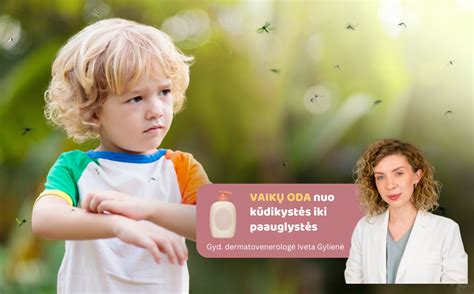Vaikų oda ir uodų įkandimai