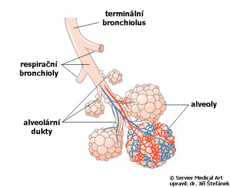 Bronchiolito paveiktos bronchų schemos