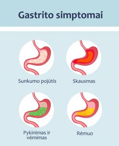 Skrandžio anatomijos schema su gastrito pažeidimu