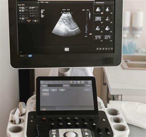 echoskopijos vaizdas